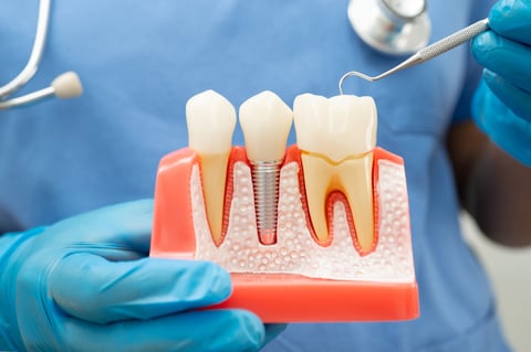 Rehabilitación bucal integral